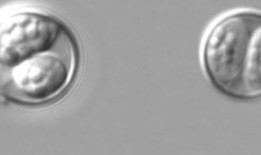 什么是环孢子虫病？这种疾病会导致“爆炸性腹泻”，阿拉巴马州的病例越来越多