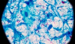 揭示结核分枝杆菌外毒素分泌及转运机制