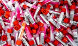 澳大利亚承认令人震惊的实验室入侵